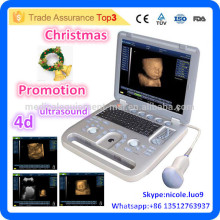 Christmas Promotion !! CU18-I New Advanced 4D Portable Ultrasound Machine Price